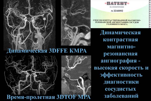 Динамическая контрастная МРА сосудов головного мозга